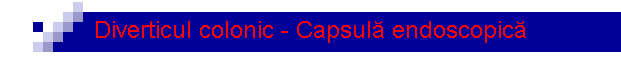 Diverticul colonic - Capsul� endoscopic�